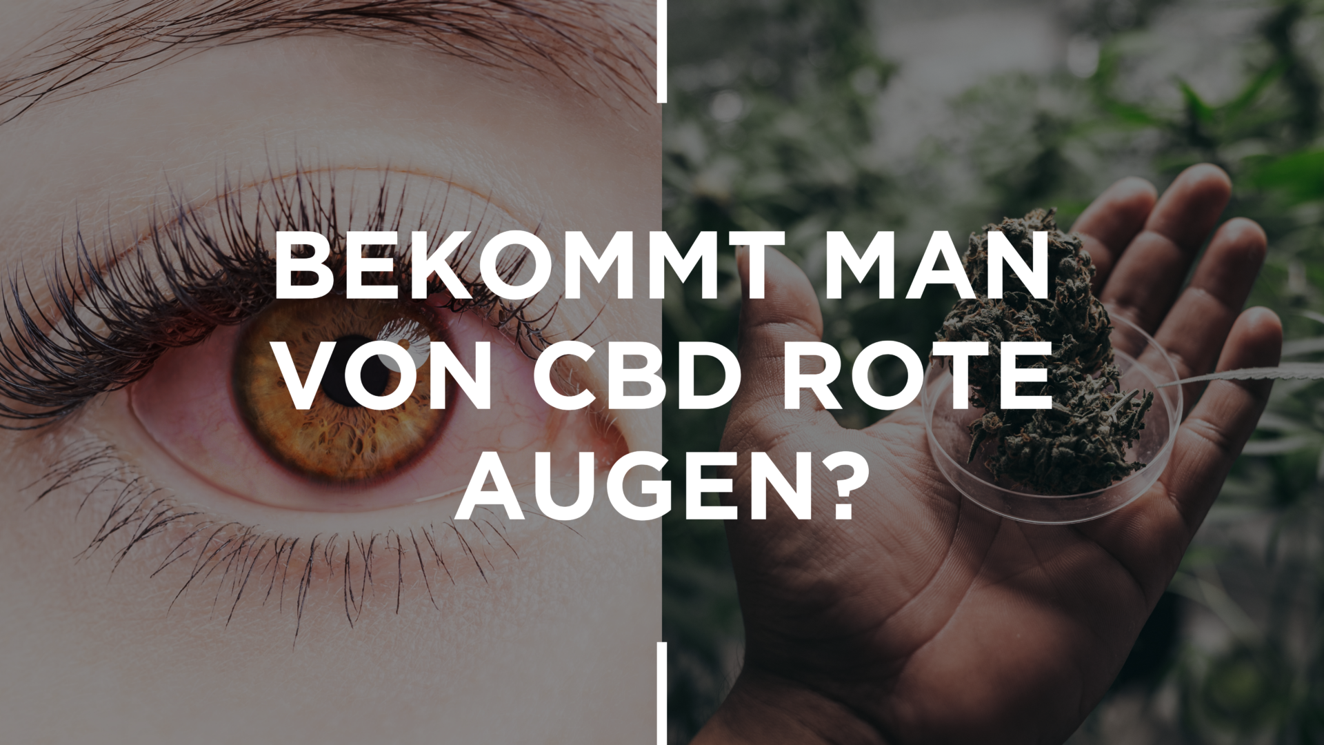 Bekommt Man Von CBD Rote Augen?